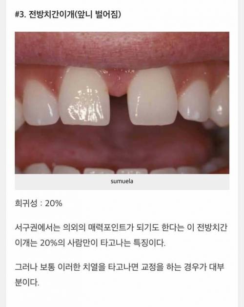 인체별 희귀한 사진.jpg