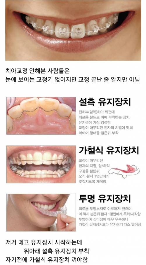 치아교정이 힘든 이유 ㄷㄷ