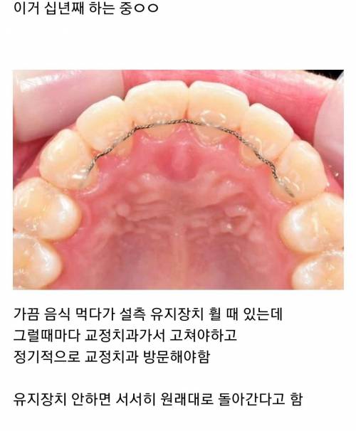 치아교정이 힘든 이유 ㄷㄷ