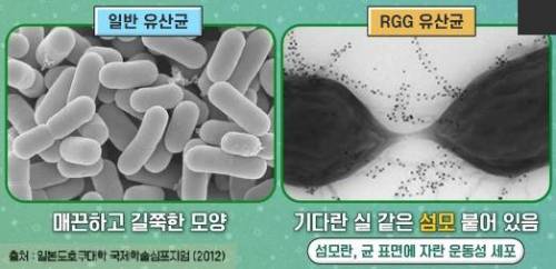 아파도 부끄러워서 병원 못 가는 질병 