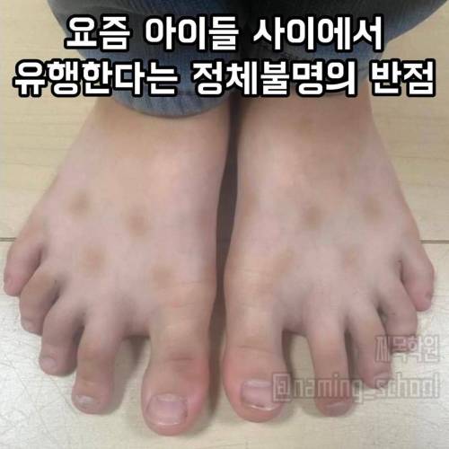 요즘 아이들 사이에서 유행한다는 정체불명의 반점 ㅋㅋ. jpg