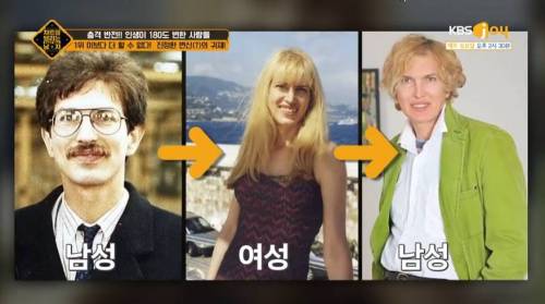 성전환 수술을 무려..3번이나 한 사람.jpg