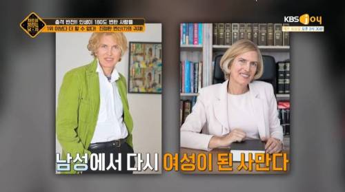 성전환 수술을 무려..3번이나 한 사람.jpg