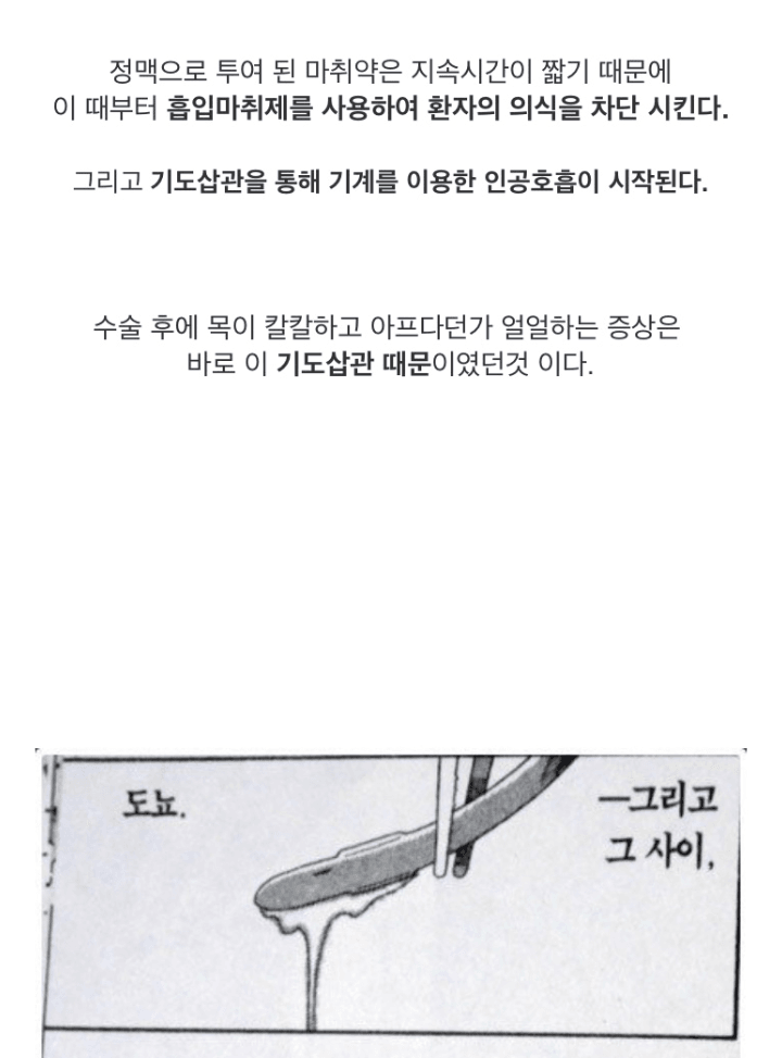 전신마취 알려주는 만화.jpg