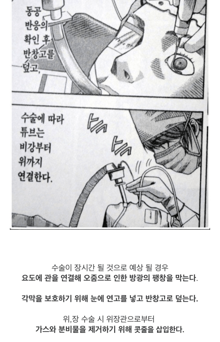 전신마취 알려주는 만화.jpg