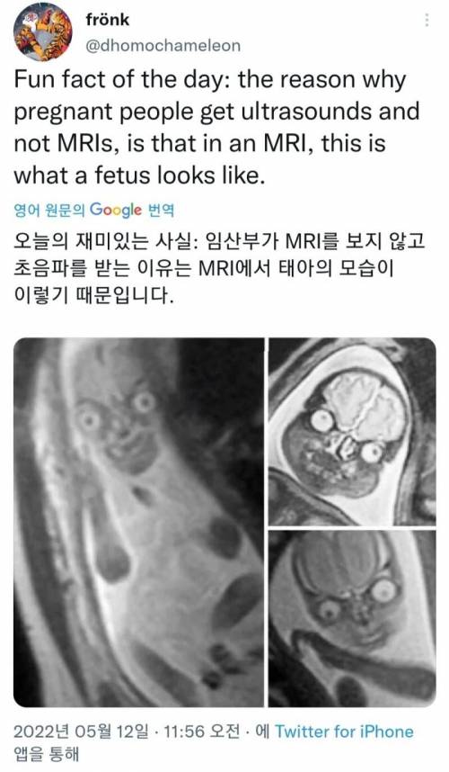 임산부가 왜 mri 안 받고 초음파 받는 이유