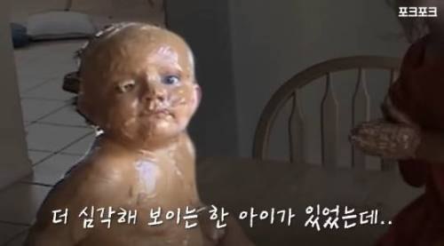 엄마 외출한 사이 땅콩 버터로 동생 팩 해준 누나