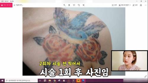 어느 유튜버의 타투제거 후기 .jpg