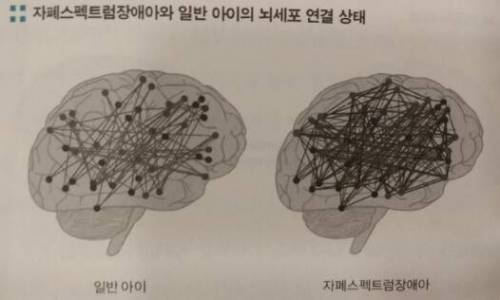 자폐 아이와 일반 아이의 뇌세포 연결상태