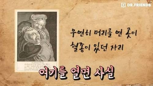 과거 사람들이 두통 생기면 뚝배기부터 열었던 이유