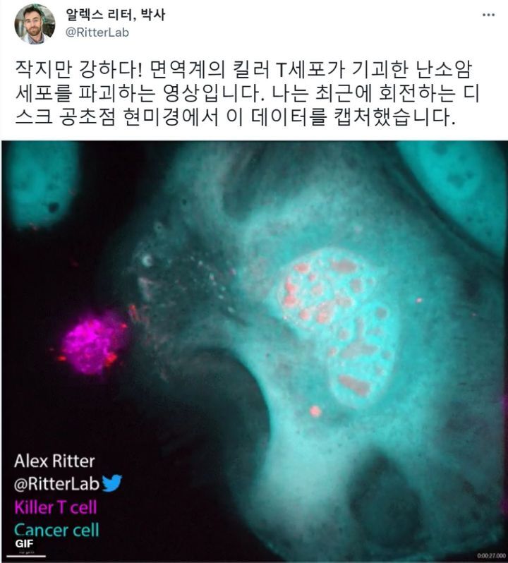 킬러 T세포가 난소암을 단숨에 파괴하는 모습