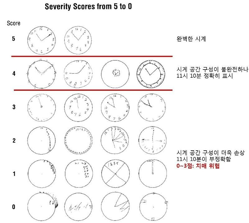 치매인이 그린 시계 (11시 10분)