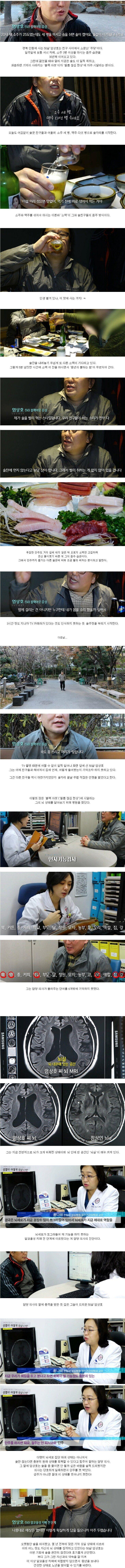 술을 많이 마시는 50대의 뇌 상태