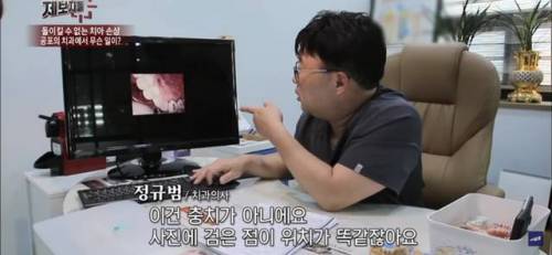 구강 카메라에 얼룩이 묻으면 충치처럼 보인다??