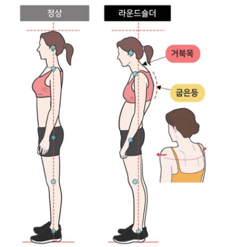 				잘 때 하는 간단한 라운드숄더에 좋은 자세