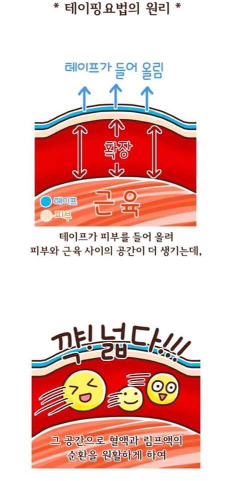 수족냉증 완화시키는 테이핑 방법 (+테이핑 원리)