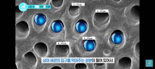 치과의사가 말하는 좋은 치약 고르는 법