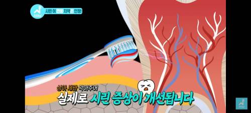 치과의사가 말하는 좋은 치약 고르는 법