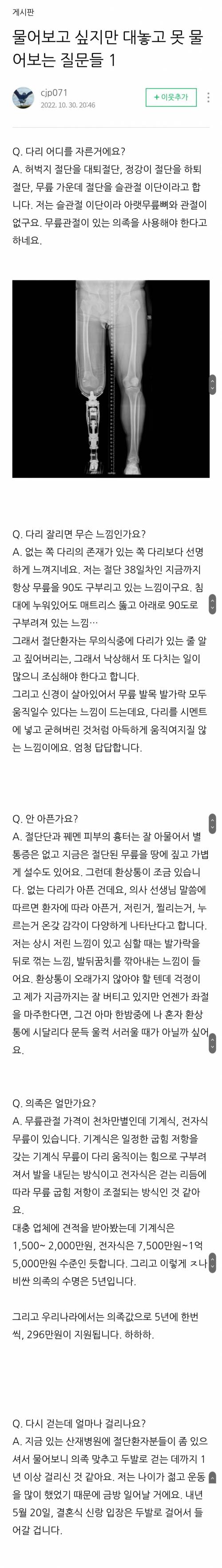 다리 절단사고를 당한 유튜버의 Q&A