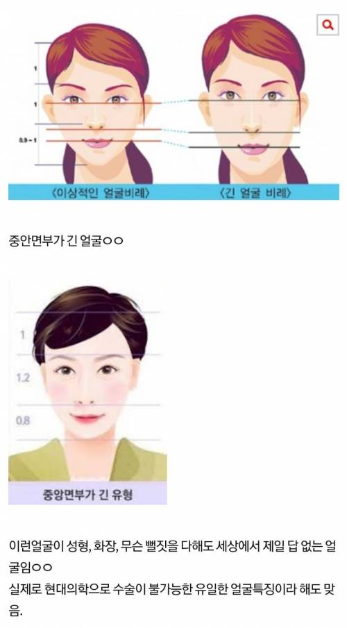 현재 성형기술로는 살릴수 없다는 얼굴형