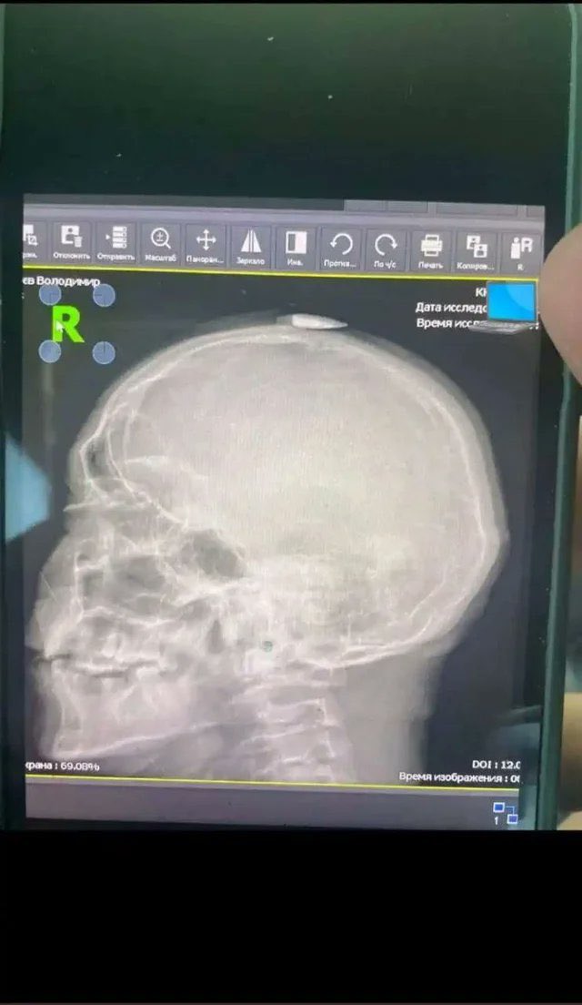격렬한 전투 후 거점으로 돌아온 우크라이나 병사