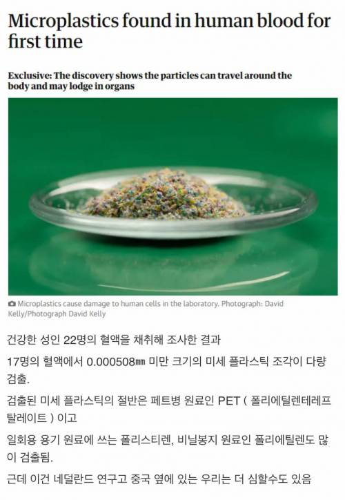 사람 혈액에서 최초로 미세 플라스틱이 검출 됐데