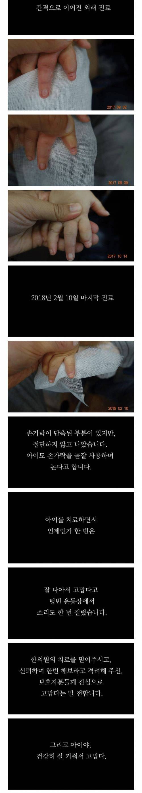 [사진주의]한의학 화상치료 레전드