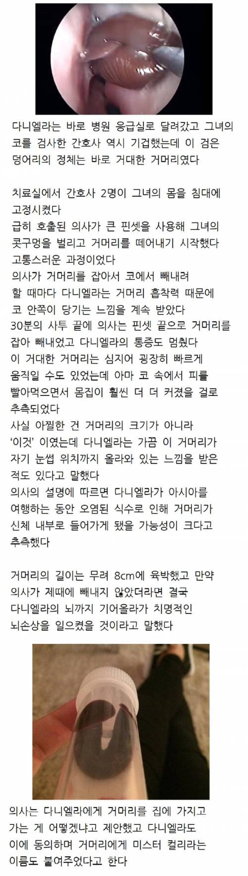 약혐 베트남 여행 갔다왔는데 코에서 무언가 나온 여성