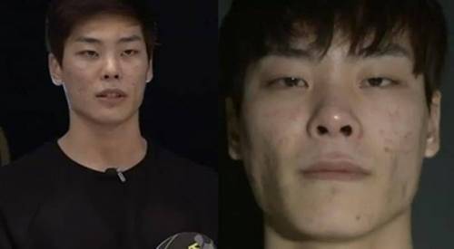 성형으로 생이 바뀐 사람.jpg