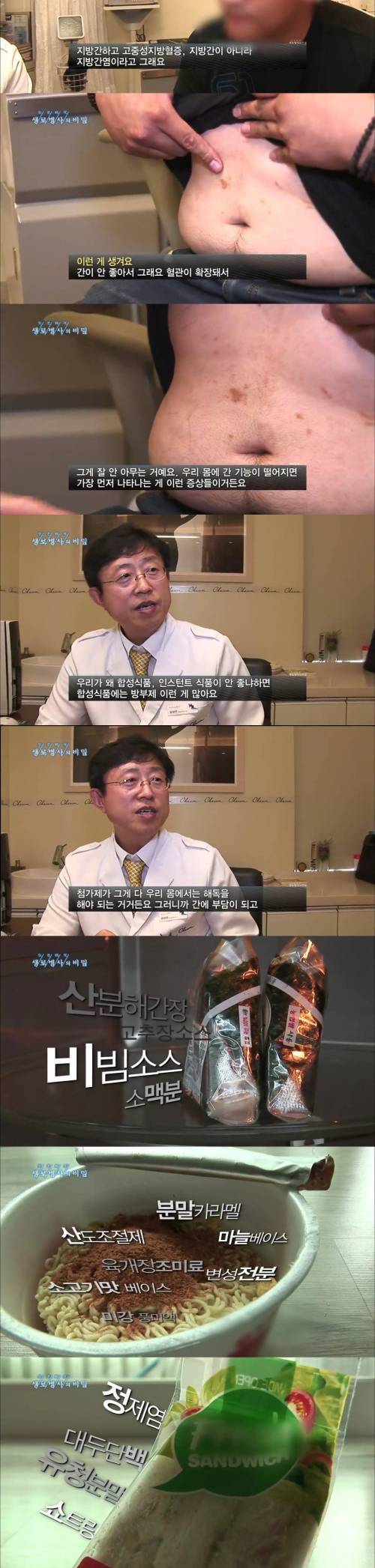 매일 인스턴트 식품을 먹는 사람의 몸상태.jpg