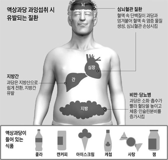 액상과당 과입섭취 시 유발되는 질환