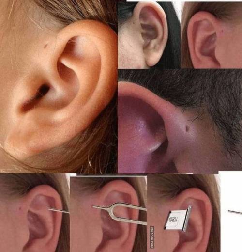 뇌에 칩을 넣는 방법