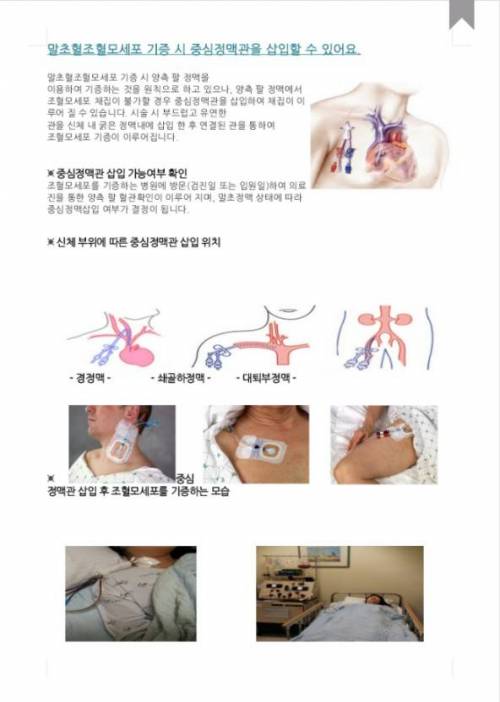 조혈모세포 기증 후기.jpg