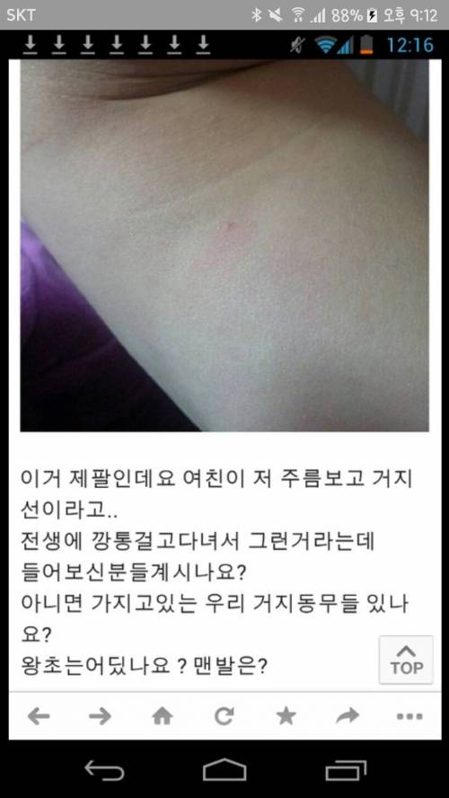 팔 안 쪽에 있는 주름 : 거지선