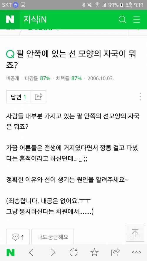 팔 안 쪽에 있는 주름 : 거지선