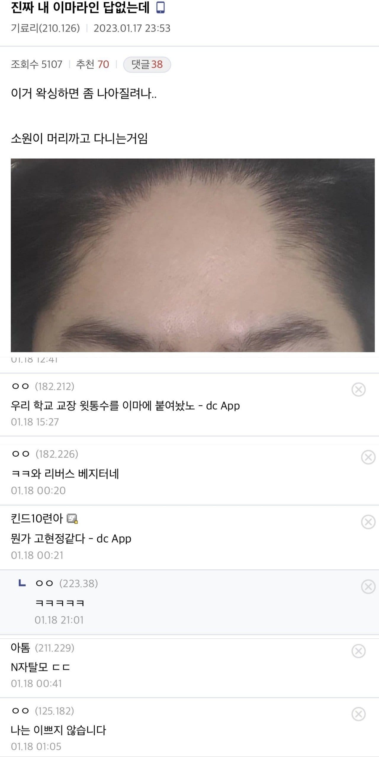 싱글벙글 디씨 헤어갤 레전드모음