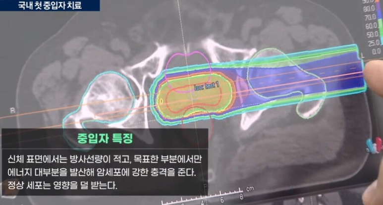 국내 암 치료 근황