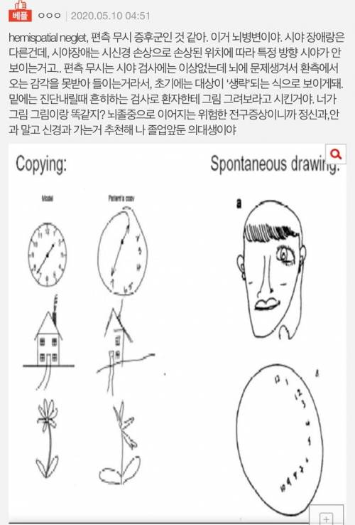 사람 눈이 한쪽만 보여..jpg