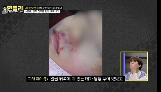 예전 한문철TV에 나왔던, 신호위반 오토바이에 치인 어린아이...