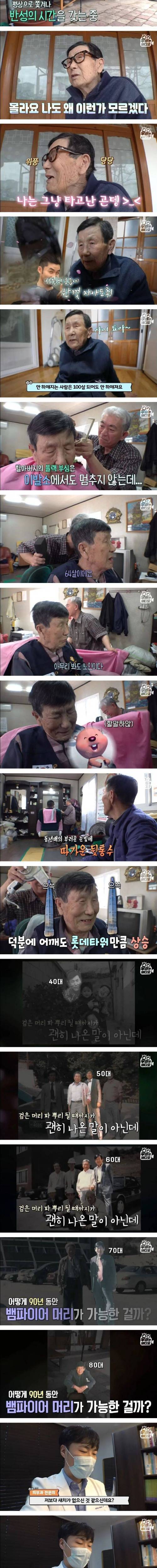 의사가 정말 부럽다고 한 94세 할아버지 머리 상태