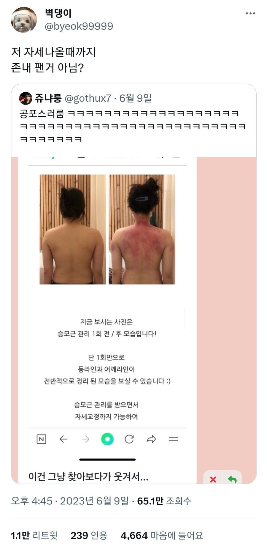 승모근 관리를 통한 자세 교정