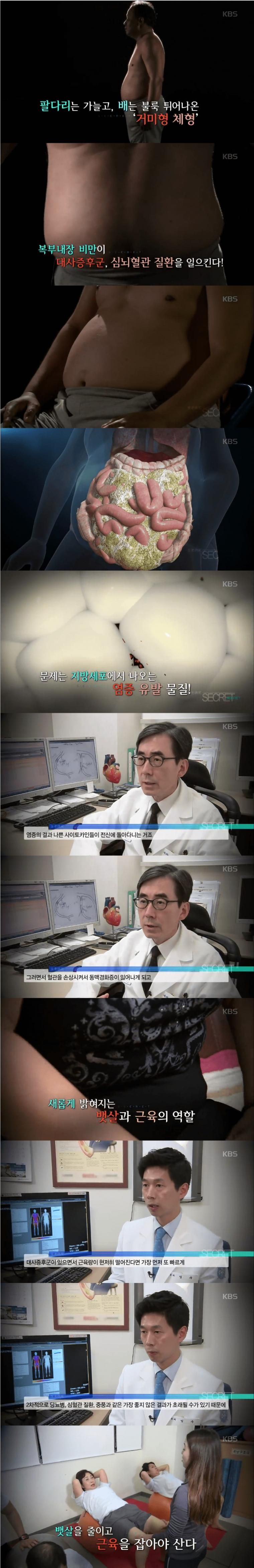 우리 주변에 많이 보이는 체형