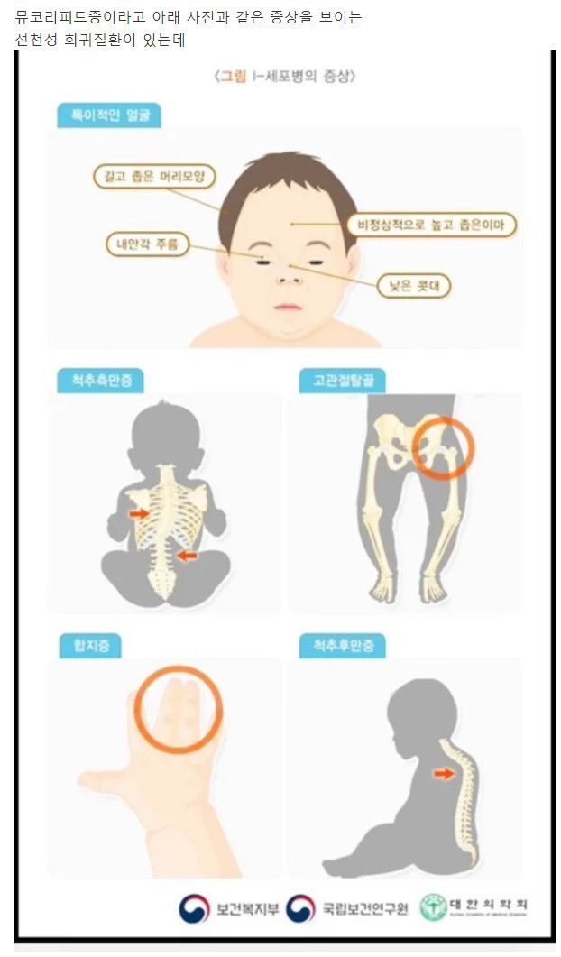 아이의 치료제 개발을 위해 이재용 팬페이지 인스타로 계속 디엠을 보낸 엄마