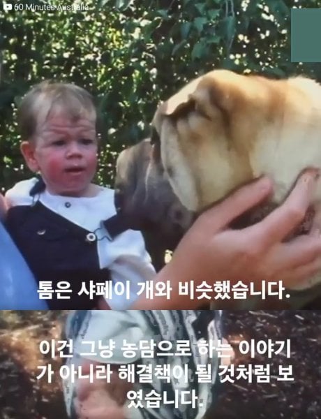 과잉 피부로 태어난 톰 테넌트의 이야기.jpg