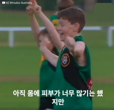 과잉 피부로 태어난 톰 테넌트의 이야기.jpg