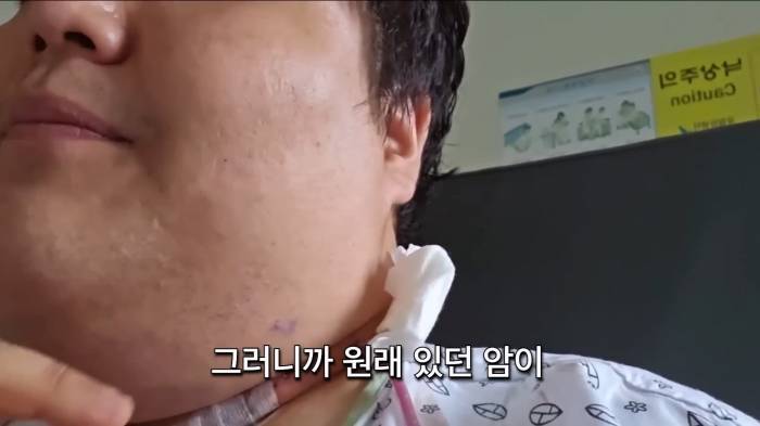 갑상선암이라고 해서 가볍게 볼게 아닌 이유