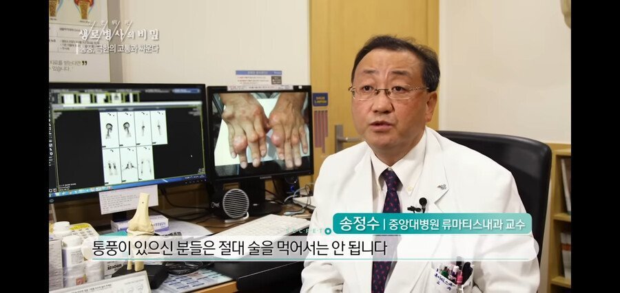 통풍 환자가 절대 먹으면 안되는 것