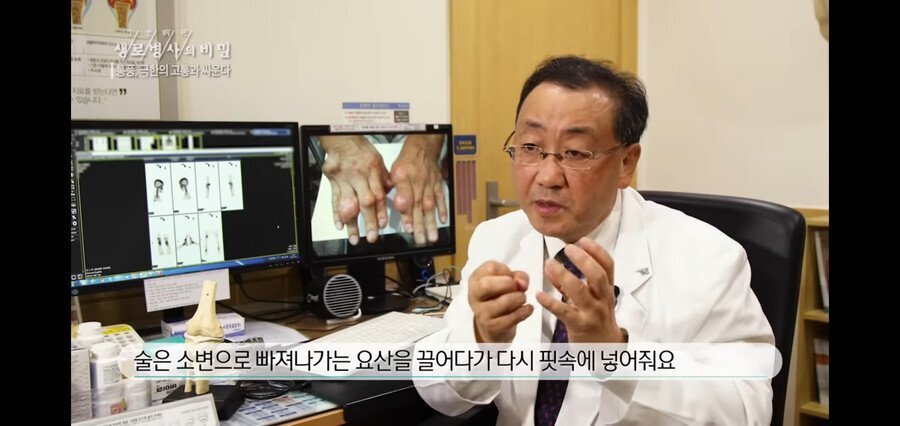 통풍 환자가 절대 먹으면 안되는 것