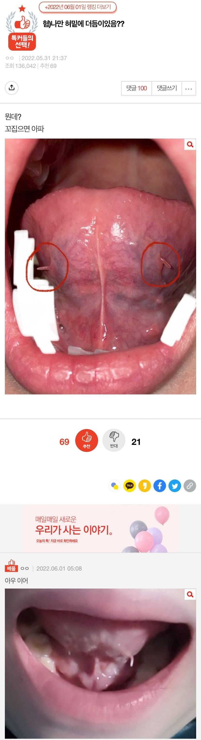 혐)나만 혀밑에 더듬이 있음? .jpg