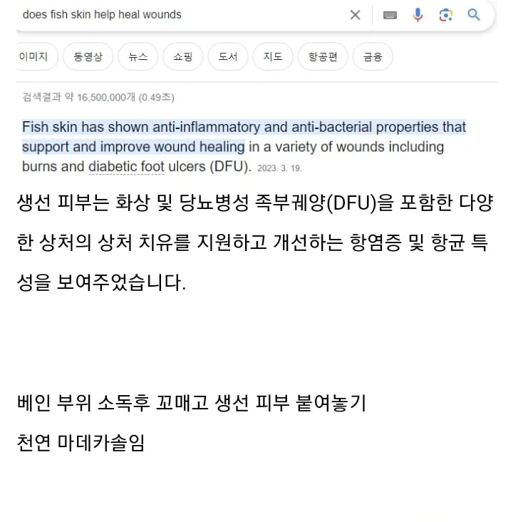 의외로 대항해시대때 나온 치료법